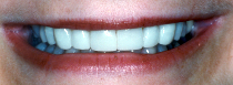 CloseUpAfterMouth.jpg (27723 bytes)