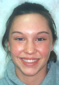 FullFaceAfter3.jpg (74977 bytes)