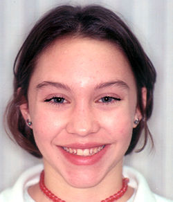 FullFaceBeforelak.jpg (15491 bytes)