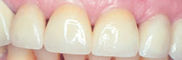 MouthAfter.jpg (3112 bytes)