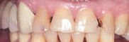MouthBefore.jpg (3316 bytes)
