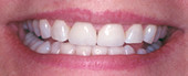 TeethAfter.jpg (5080 bytes)