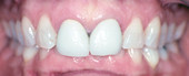 TeethBefore.jpg (4871 bytes)