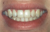 before.jpg (4305 bytes)